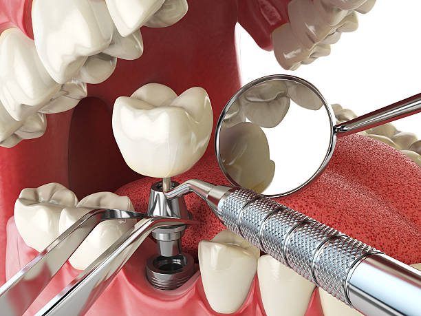 Best Emergency Denture Repair in Merrydale, LA